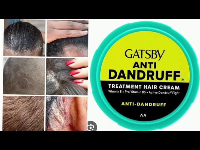 Anti Dandruff Treatment Hair Cream - Designed To Soothe The Scalp, Reduce Dandruff & Itchiness, Moisturize&Condition Hair and Scalp.