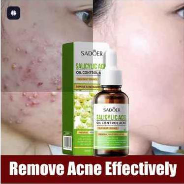 Acne Removal Salicylic Acid Face Serum Acne Treatment Repair Spots Scar Moisturizing Oil Control Shrink Pore Skin Care Products – SADOER