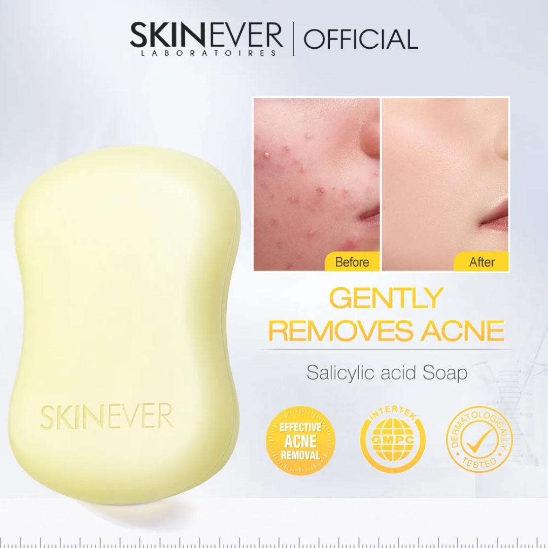 SKINEVER Salicylic Acid Acne Soap Bar 80g - Refreshing Face & Body Cleansing Bar with Niacinamide + Centella for Oil Control, Deep Pore Cleansing, Acne-Prone Skin