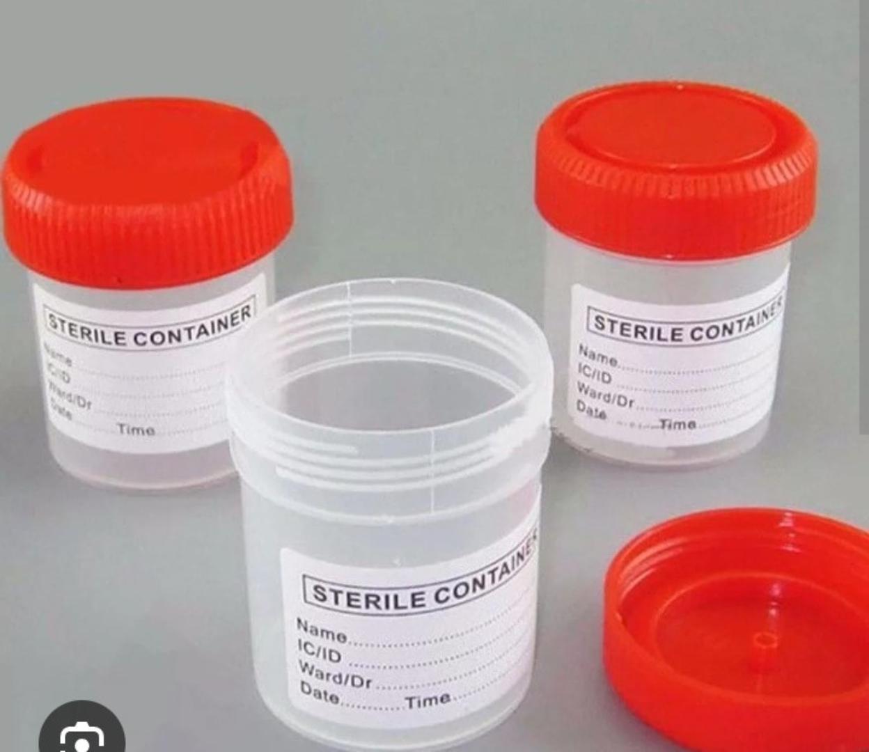 URINE/STOOL CONTAINER 50PCS- WITH SCOOP 50ML
