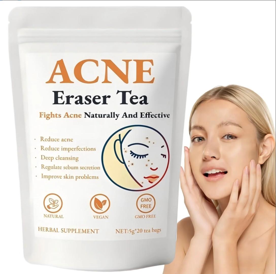 ACNE ERASER TEA – NATURAL SKIN GLOW & CLEAR FACE HERBAL DETOX (20 TEA BAGS)