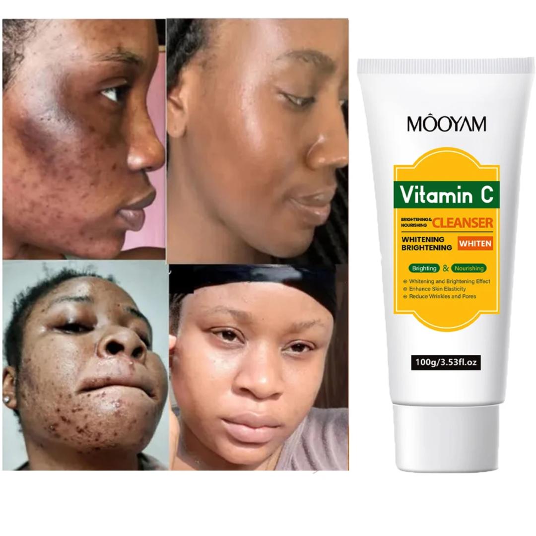 MOOYAM VITAMIN C FACIAL CLEANSER 100G – DEEP CLEANSING, BRIGHTENING & ANTI-AGING FACE WASH FOR GLOWING SKIN.