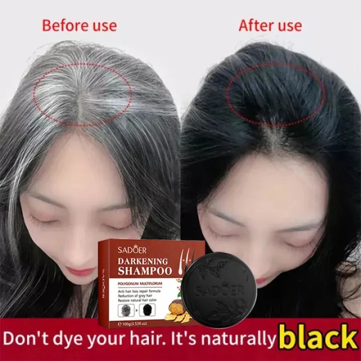 Hair Darkening Soap Shampoo, Reduce Grey Hair,Restore Natural Hair Color,Anti Hairloss Repair Formular,polygonum multiflorum Anti Grey Hair Controls Oil and Dandruffs, Prevents Hairloss, Repair