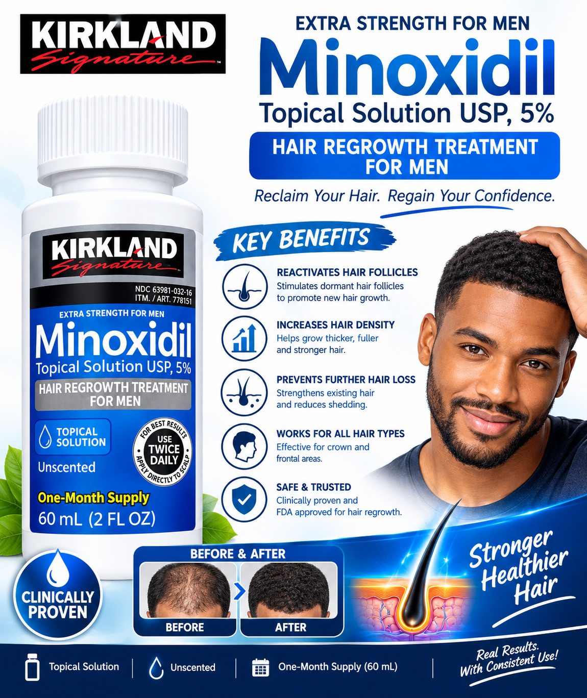 Kirkland Signature Minoxidil 5% Topical Solution for Men 60ml – Extra Strength Hair Regrowth Treatment