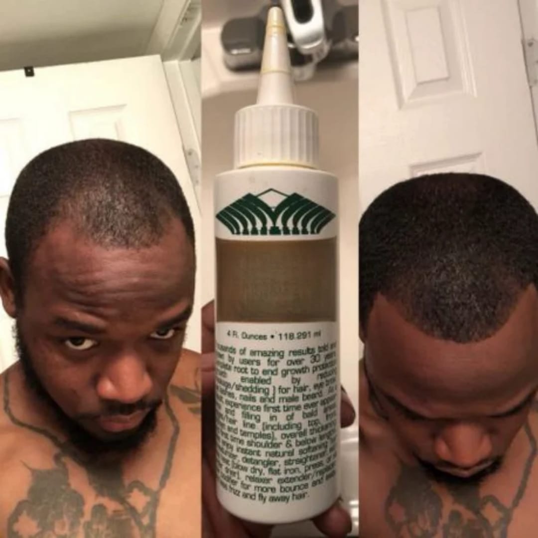 Wild Growth Hair Oil 118ml – Hair Growth & Strengthening Oil for Hair, Scalp, Edges, Eyebrows & Beard