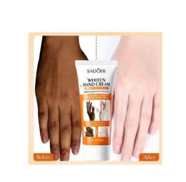 Whitening Hand Cream - 100g - Moisturizing Anti-Chapping All-Year-Long Hand Cream - Suitable for rough, dull and dry hand skin