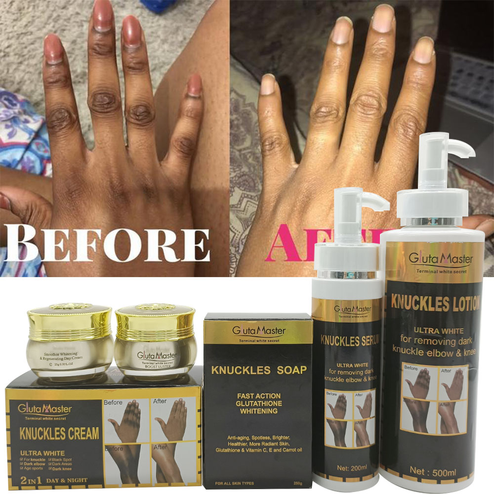 Gluta Master Terminal White Secret Knuckles Lotion for removing dark knuckles, elbows, and knees.Formulated for hyperpigmentation and aims to lighten and even out skin tone on joints.