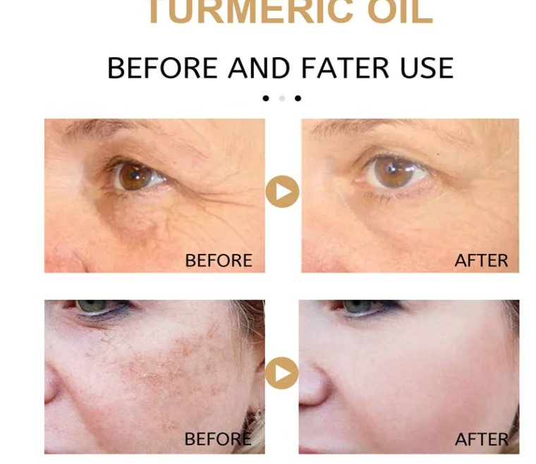 Turmeric Essence Serum 30ml/Anti-Aging/Brightening/Hydrating for Unisex/Hydrating Brightening Anti-Wrinkle Essence  Its lightweight texture absorbs quickly, perfect for daily morning and night use .