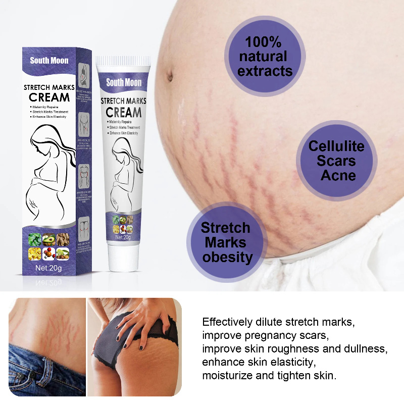 South Moon Stretch Marks Cream 20g Maternity Repair for Abdomen Hips Thighs Chest Skin Elasticity Moisturizing