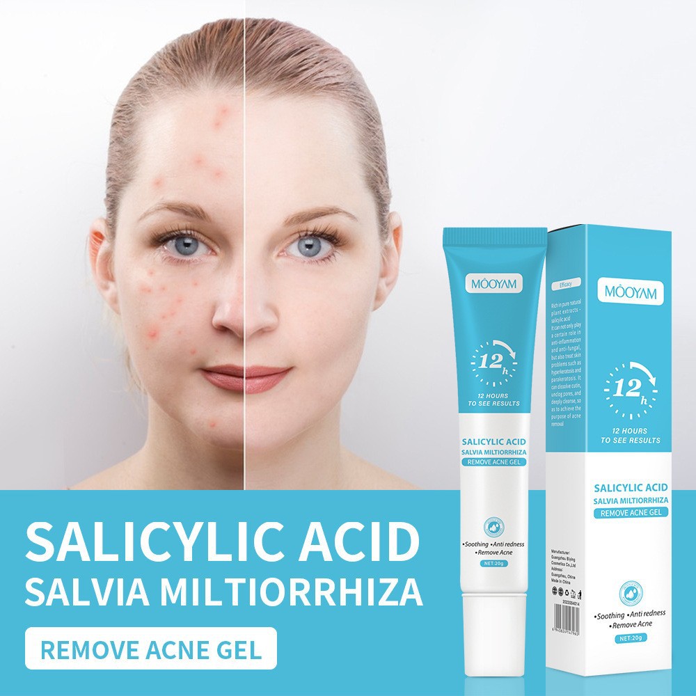 Salicylic Acid Acne Cream 12H Fast Result For Face, Remove Acne Pimple Blackhead Closed Comedones, Fade Acne Scars Dark Marks, Anti Redness Soothing Oil Control Pore Minimizer, For Women Men Teens