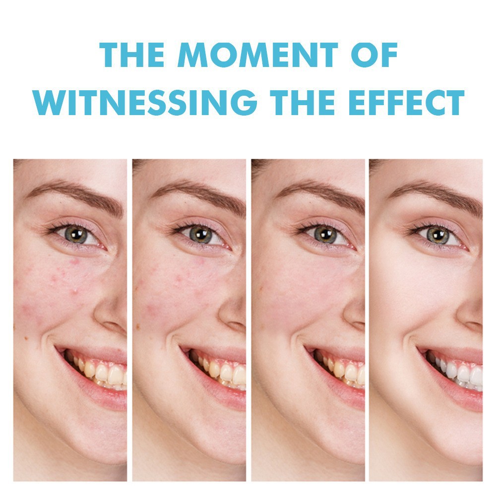 Salicylic Acid Acne Cream 12H Fast Result For Face, Remove Acne Pimple Blackhead Closed Comedones, Fade Acne Scars Dark Marks, Anti Redness Soothing Oil Control Pore Minimizer, For Women Men Teens
