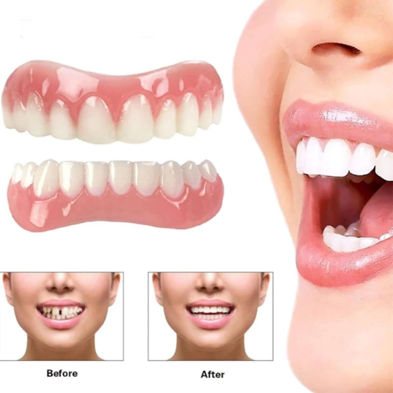 1 Set Upper & Lower Gum Veneers Dentures - Instant Smile Makeover, Natural-Looking Teeth Replacement, Comfortable & Easy to Use, Durable Plastic Material, Affordable Dental Solution for Men & Women