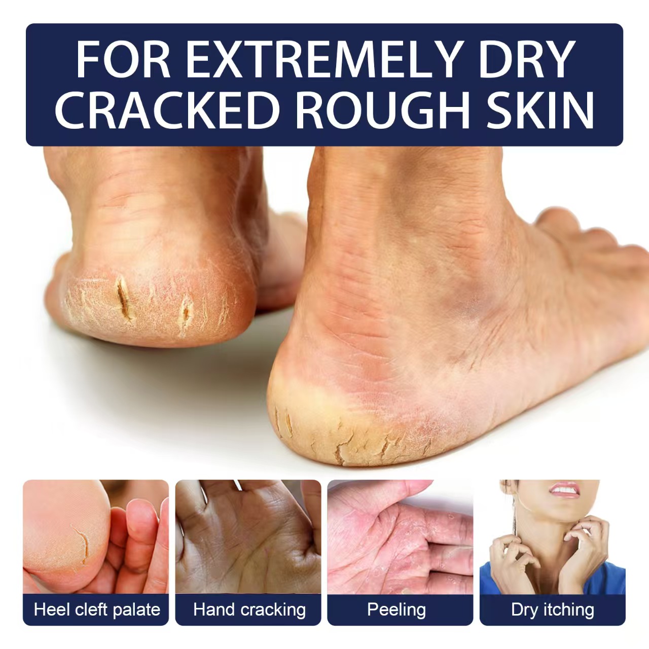 50 PCS Cracked Tape +88g Anti Crack Foot Cream Dryness Foot care set Foot Mask Heel Cracked Repair Cream  feet treatment cracked heel repair kit