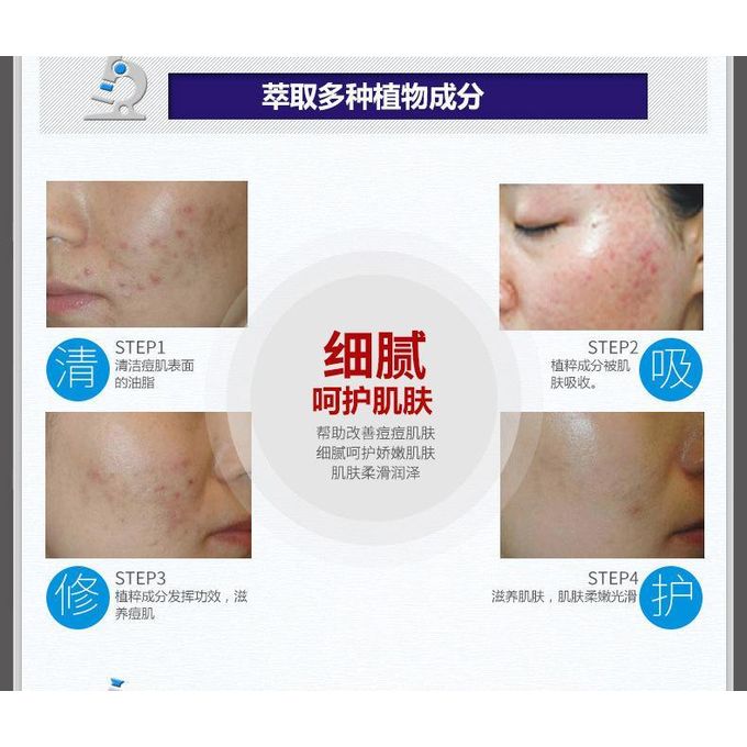 BIOAQUA Acne-Smoothing Cream white-30g