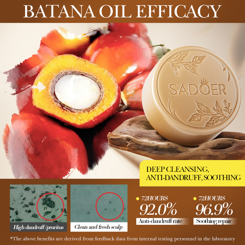 SADOER 2-Piece Organic Batana Oil Hair Set – 30ml Batana Hair Spray + Batana Shampoo Soap Bar, Scalp Soothing Anti Loss Hair Growth Treatment Duo Price in Kenya Original Nairobi Delivery