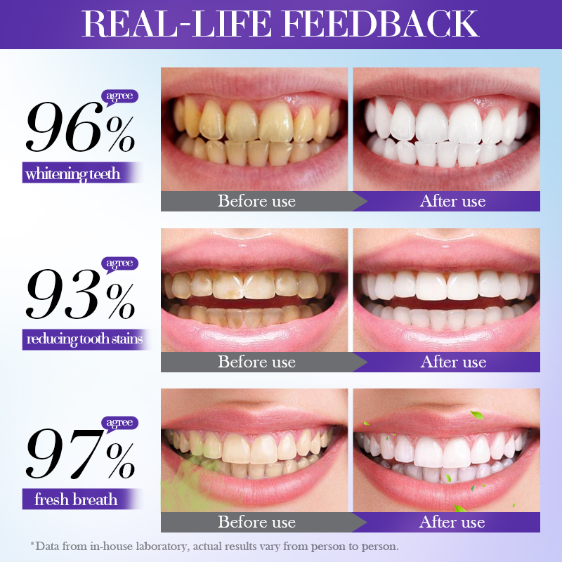 SADOER V34 Purple Teeth Whitening Toothpaste 100g - Colour Corrector Instant Whitener for Yellow Teeth Stains Removal, Fresh Breath Oral Care Gel for Coffee & Smoke Stains Neutralizer & Brightening