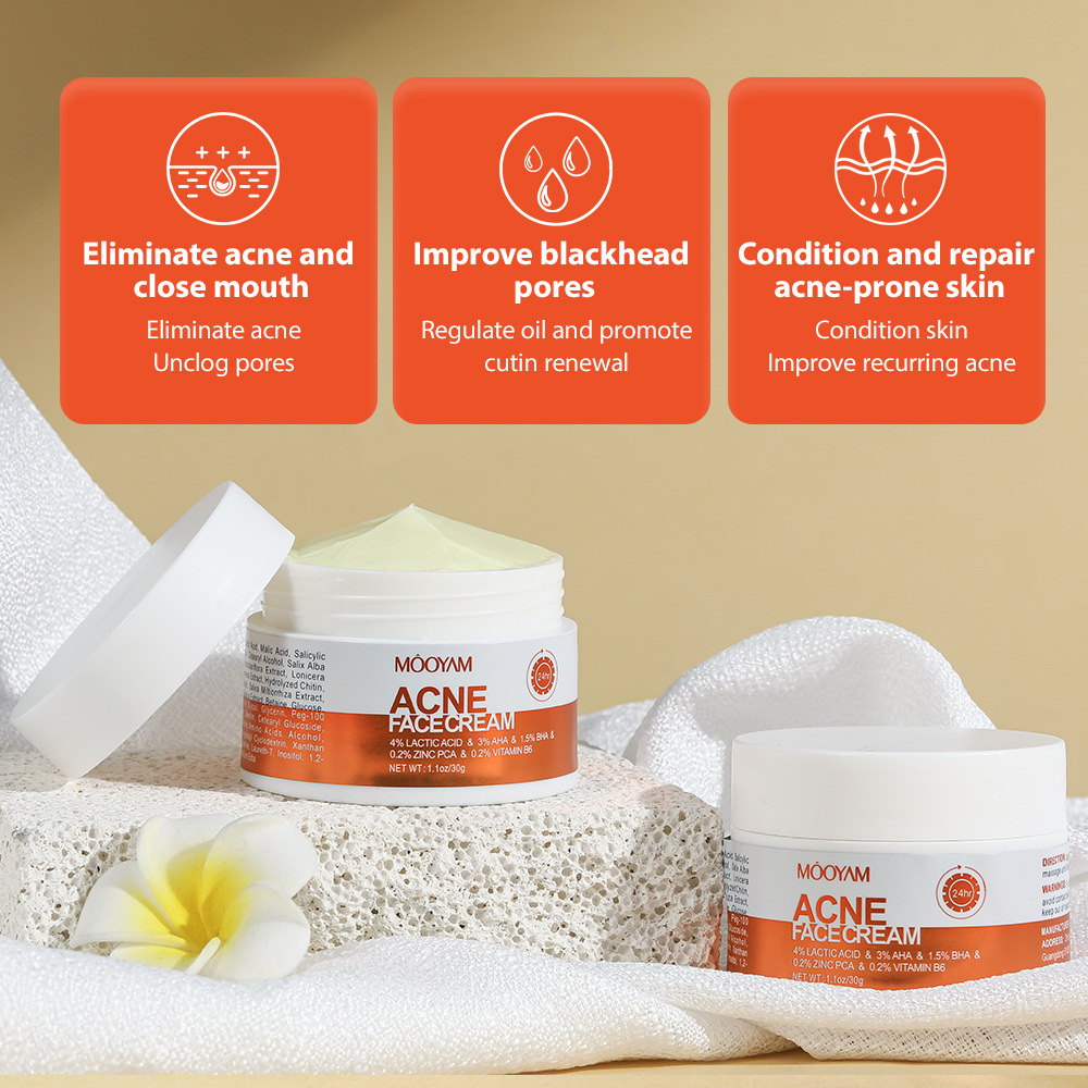 Mooyam Acne treatment Face Cream – Acne Treatment, Blemish Control, Exfoliating Cream for Clear Skin 30g Fast Delivery In Stock
