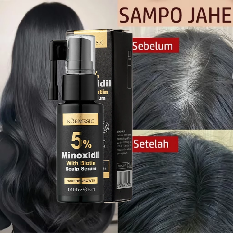 5% Minoxidil Hair Growth for Men and Women, Minoxidil Hair Growth Serum, Promotes Hair Growth, Strengthens Hair Follicles, Helps Prevent Hair Fall and Hair Loss Revitalise Hair And Beard Regrowth -