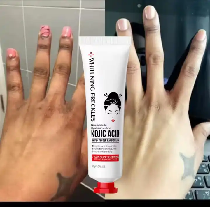 Whitening Kojic Acid Hand Cream Moisturizing Anti-chapping Nourishing Brightening Hydrating Hand Cream, Anti-wrinkle Hand Cream Skin Soften Anti-drying Whitening Beauty Hands Skin Care Products-SADOER