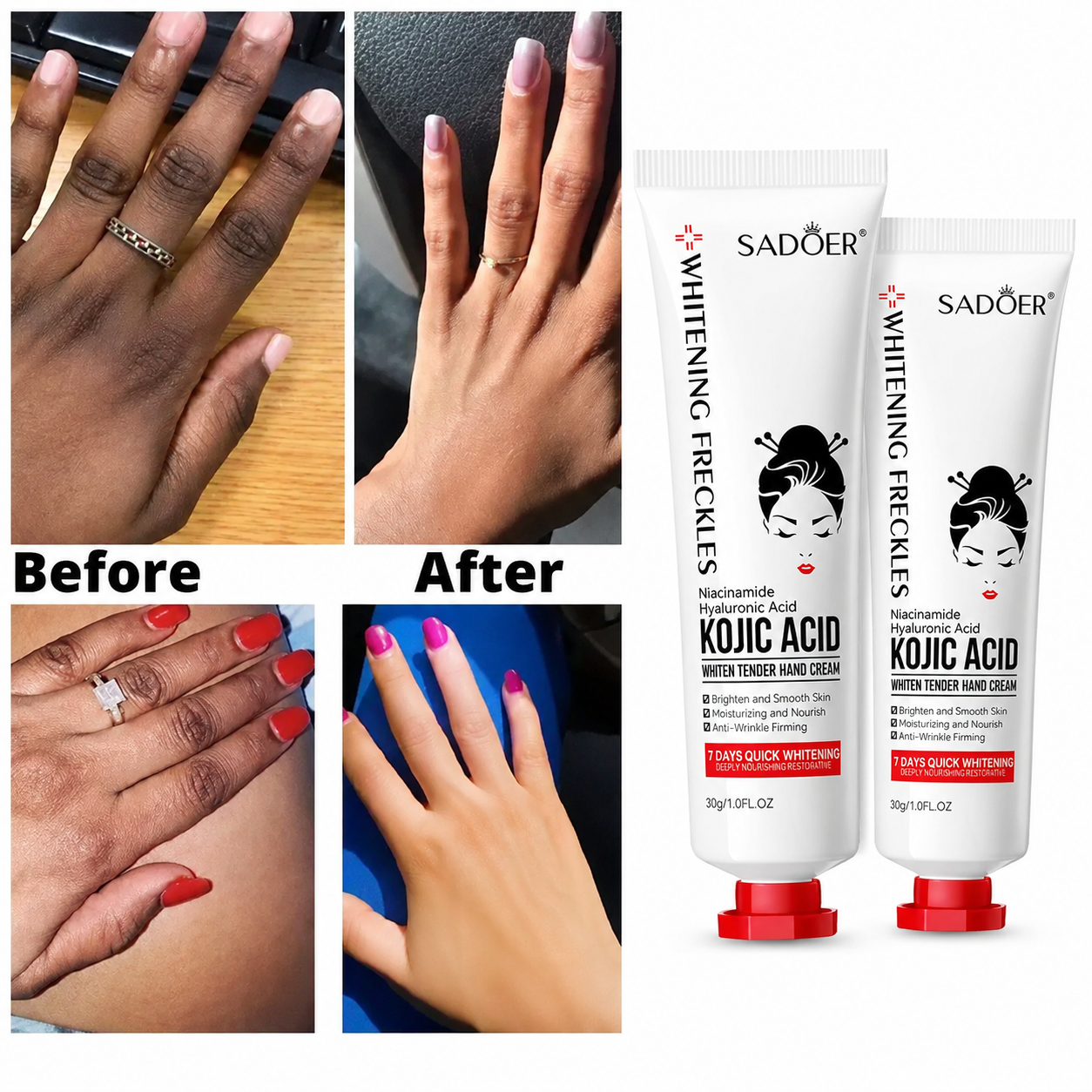 Whitening Kojic Acid Hand Cream Moisturizing Anti-chapping Nourishing Brightening Hydrating Hand Cream, Anti-wrinkle Hand Cream Skin Soften Anti-drying Whitening Beauty Hands Skin Care Products-SADOER