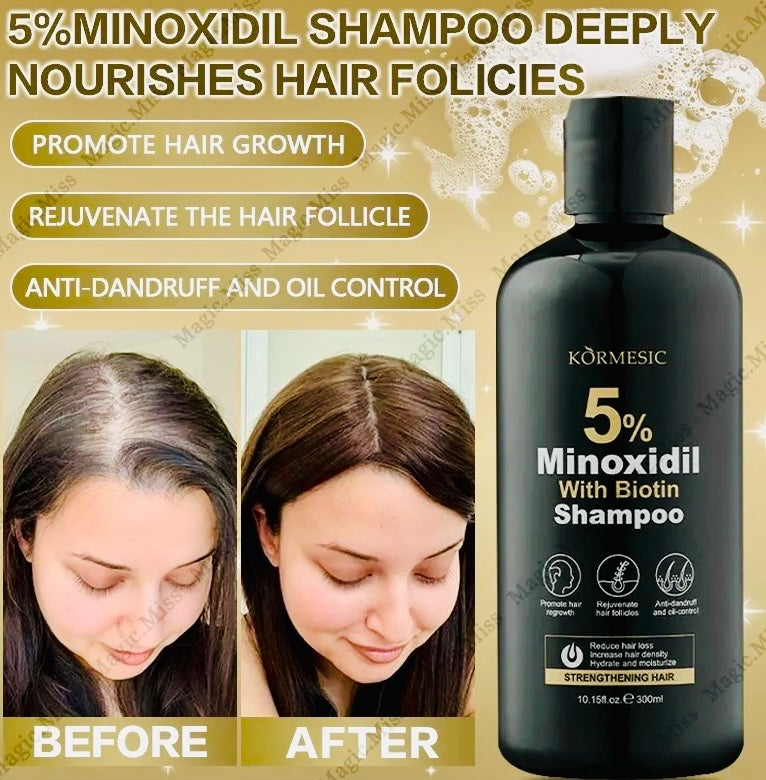 5% Minoxidil Shampoo for Women & Men - Hair Growth Shampoo, Anti Hair Loss Treatment for Thinning Hair & Receding Hairline, Strengthens Roots & Promotes Regrowth-Thicker Fuller Hair