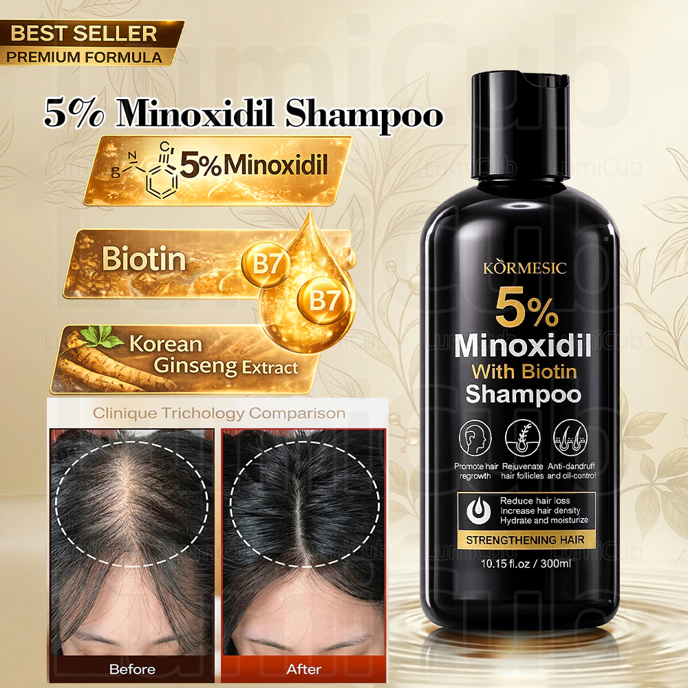5% Minoxidil Shampoo for Women & Men - Hair Growth Shampoo, Anti Hair Loss Treatment for Thinning Hair & Receding Hairline, Strengthens Roots & Promotes Regrowth-Thicker Fuller Hair