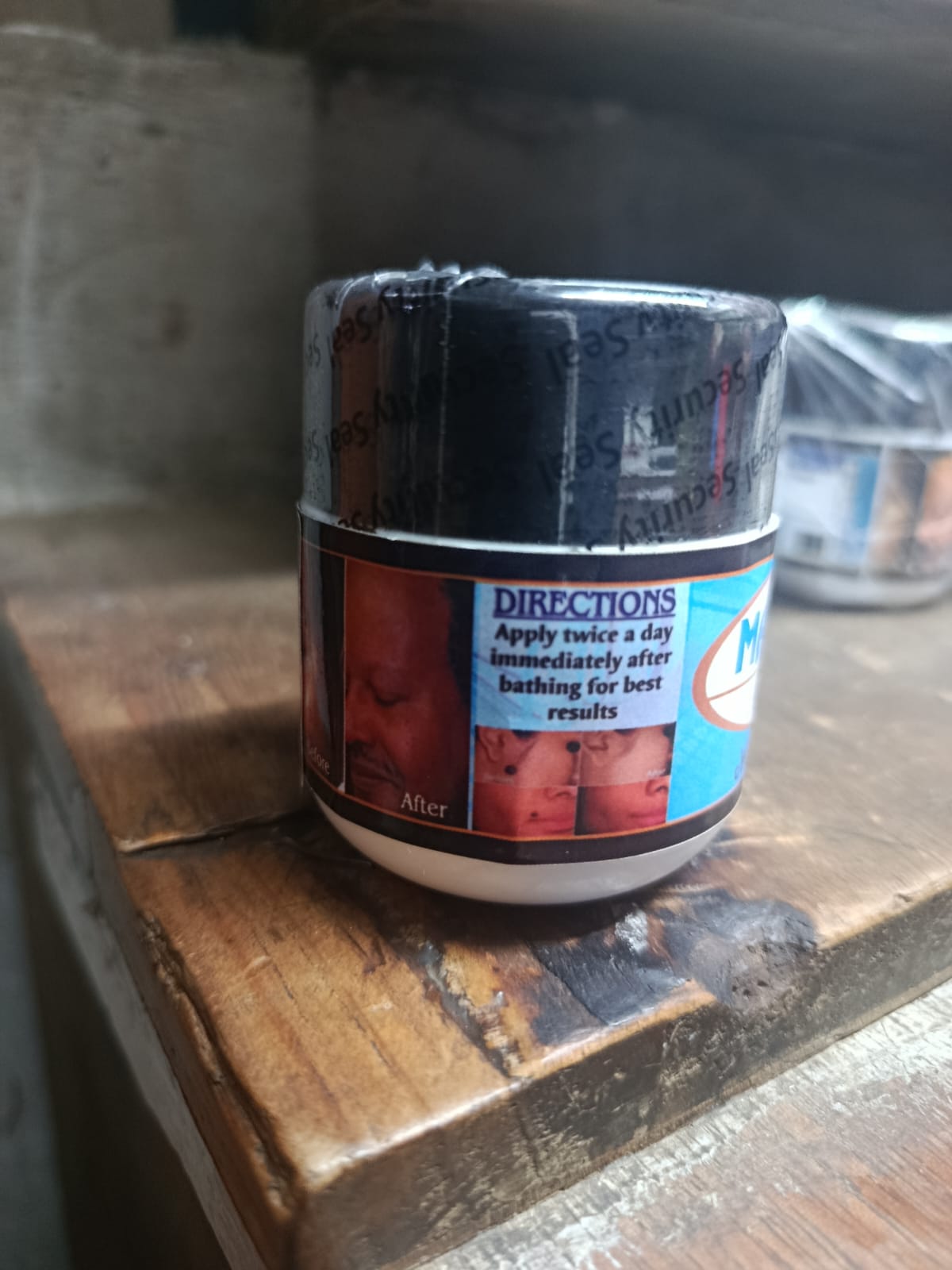 MAGIC WARTS Removal Cream 70 Grams