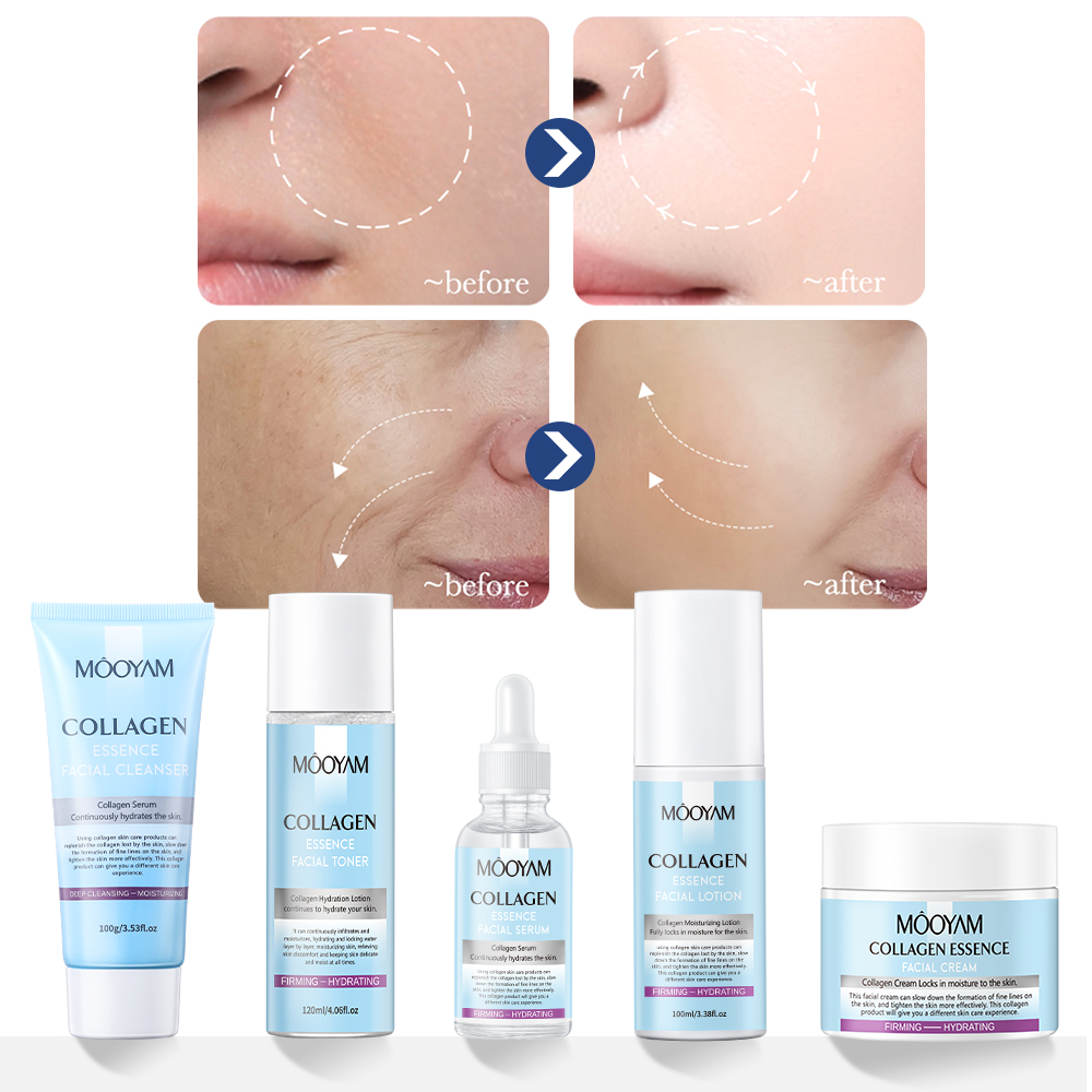 HYDROLYZED COLLAGEN SKIN PERFECTION SKINCARE SET - COMPLETE 5-PIECE ANTI-AGING RITUAL FOR FIRMING, WRINKLE REDUCTION & YOUTHFUL RADIANCE