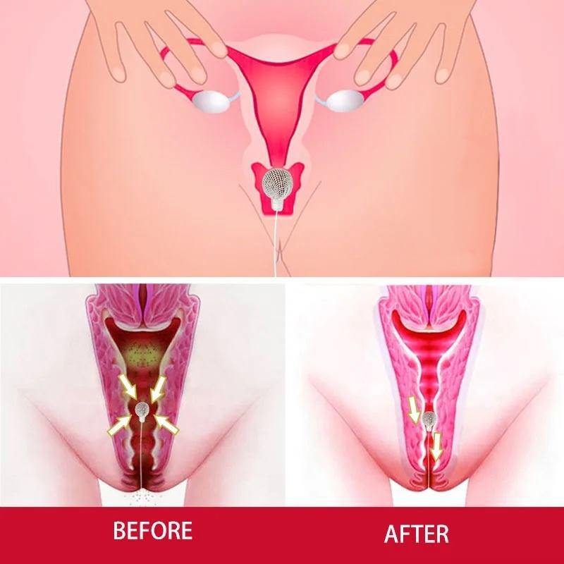 YONI DETOX PEARLS FEMININE INTIMATE CLEANSE, VAGINAL TIGHTENING, ODOR REDUCE, NATURAL HERBAL PH BALANCE