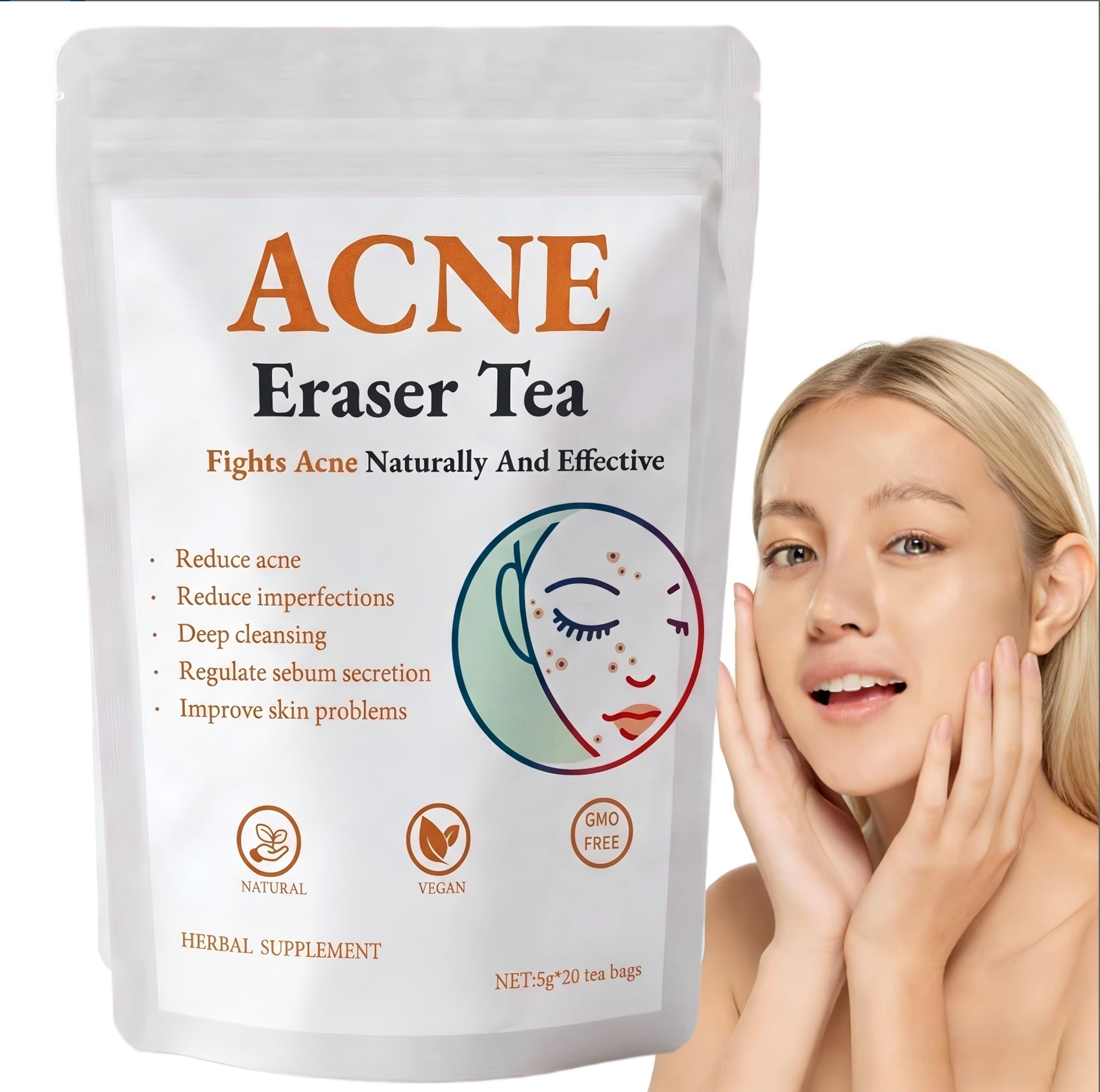 NATURAL ACNE ERASER TEA (20 LARGE 5G TEA BAGS) – PIMPLES, DARK SPOTS & HORMONAL BREAKOUT RELIEF, DEEP BLOOD PURIFYING SKIN GLOW TEA (CAFFEINE-FREE)