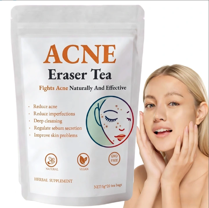 NATURAL ACNE ERASER TEA (20 LARGE 5G TEA BAGS) – PIMPLES, DARK SPOTS & HORMONAL BREAKOUT RELIEF, DEEP BLOOD PURIFYING SKIN GLOW TEA (CAFFEINE-FREE)