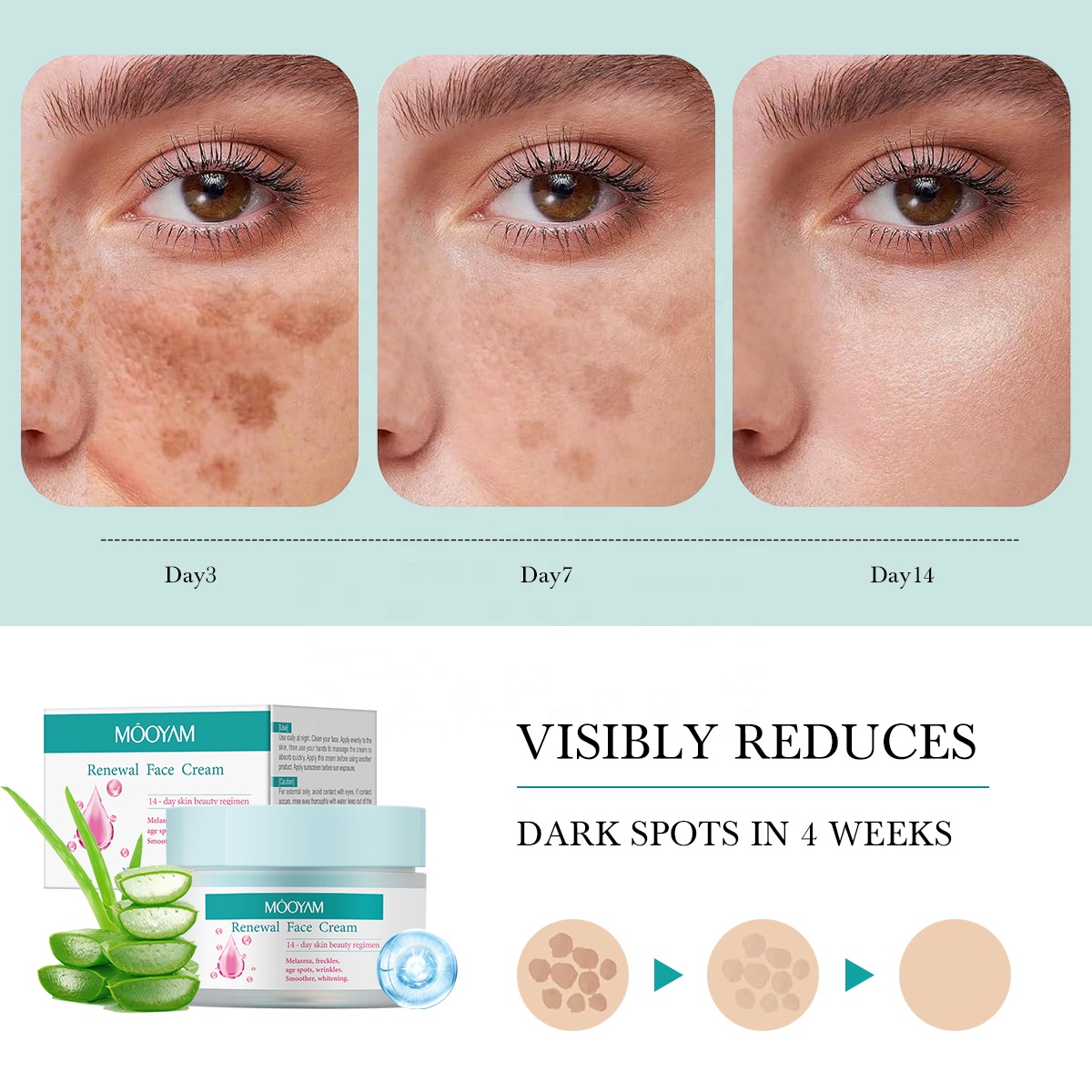 MOOYAM Renewal Face Cream for Melasma and Freckles Treatment, Age Spots Brightening, Anti-wrinkle, Smoother and Whitening Face Cream Renewal Facial Cream
