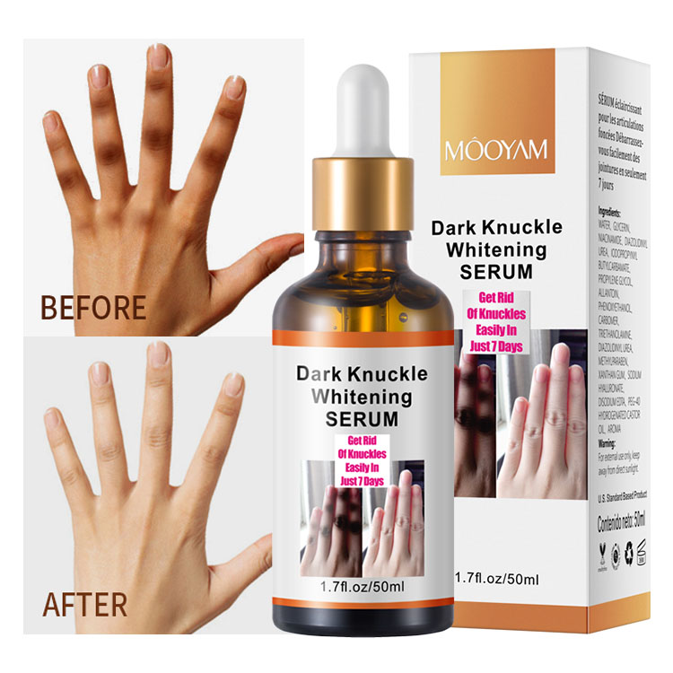 Dark Knuckle whitening Serum Elbows, Knees, Knuckles Remover Whitening Serum Skin Lightening Dark Spots Remover Discoloration Body Whitening Serum- Mooyam