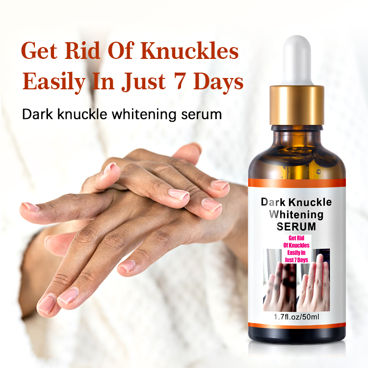 Dark Knuckle whitening Serum Elbows, Knees, Knuckles Remover Whitening Serum Skin Lightening Dark Spots Remover Discoloration Body Whitening Serum- Mooyam