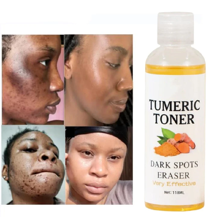 MOOYAM Dark Spots Remover Corrector Serum Tumeric Toner Acne Remover Fade Dark Spots Eraser Skin Care Serum Brighten Turmeric Toner Dark Moisturizing Essence