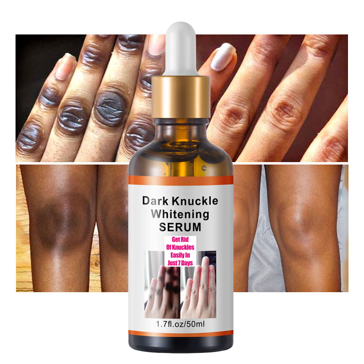 Dark Knuckle whitening Serum Elbows, Knees, Knuckles Remover Whitening Serum Skin Lightening Dark Spots Remover Discoloration Body Whitening Serum- Mooyam