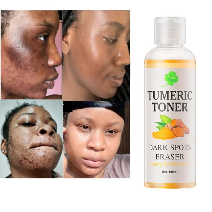 MOOYAM Dark Spots Remover Corrector Serum Tumeric Toner Acne Remover Fade Dark Spots Eraser Skin Care Serum Brighten Turmeric Toner Dark Moisturizing Essence