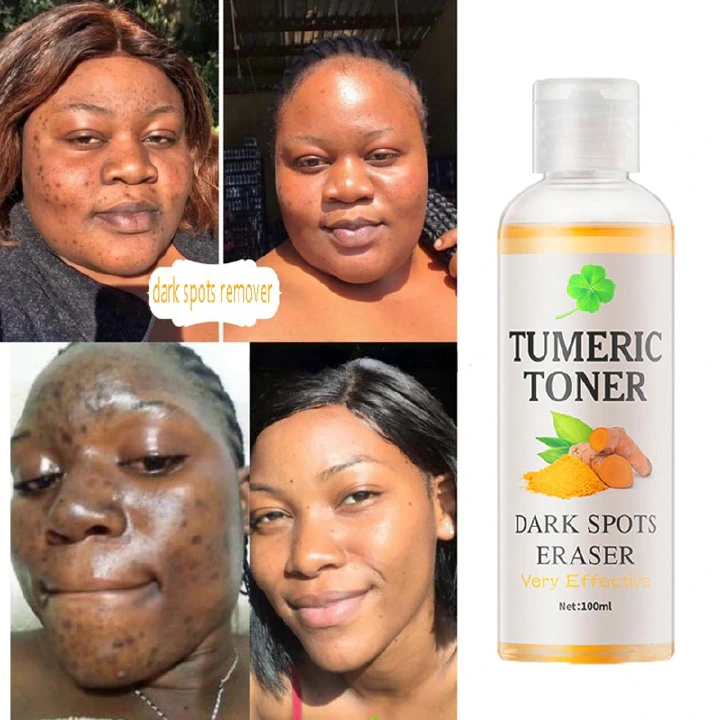 MOOYAM Dark Spots Remover Corrector Serum Tumeric Toner Acne Remover Fade Dark Spots Eraser Skin Care Serum Brighten Turmeric Toner Dark Moisturizing Essence