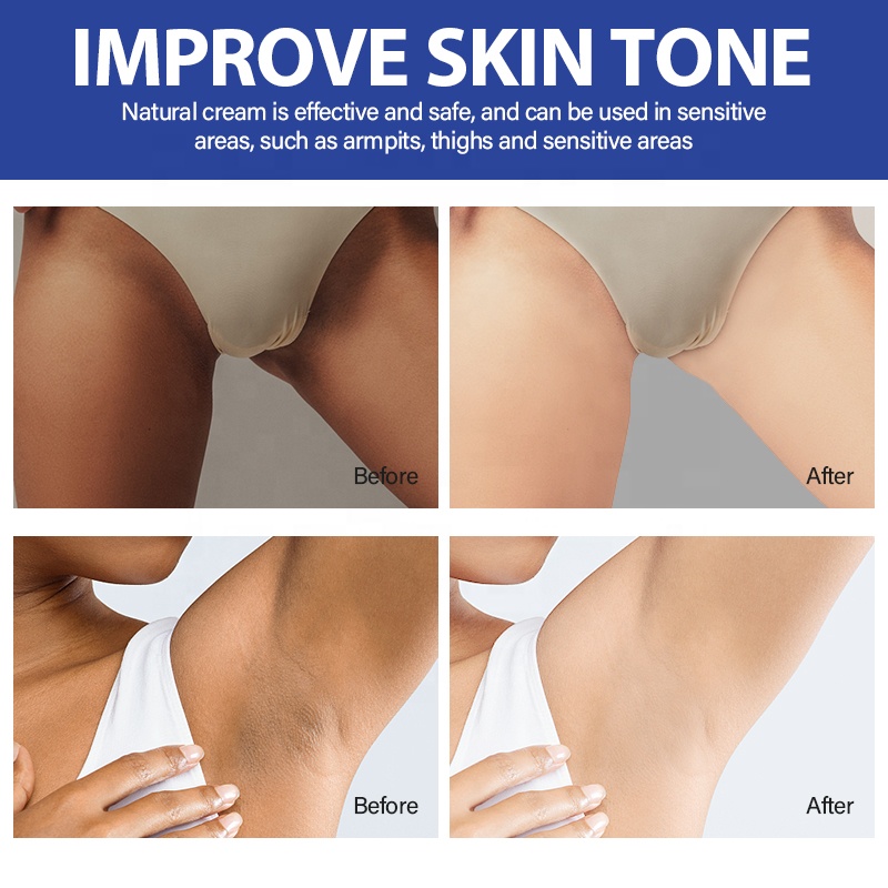 MOOYAM Intense Whitening Cream Dark Spots Eraser Face Body Underarm Private Parts Brightening Elbow Inner Thigh Armpit  Neckline Bikini Area Patches discolored skin Cream