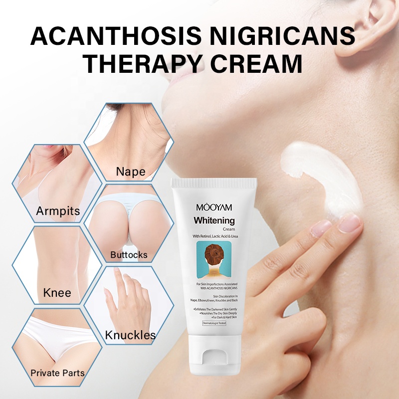 MOOYAM Whitening Cream with Retinol, Lactic Acid, Urea Acanthosis Nigricans Remove Black Patches Dark Spot Corrector Knee Elbow Underarm Knuckles Neck Lightening Skin Cream