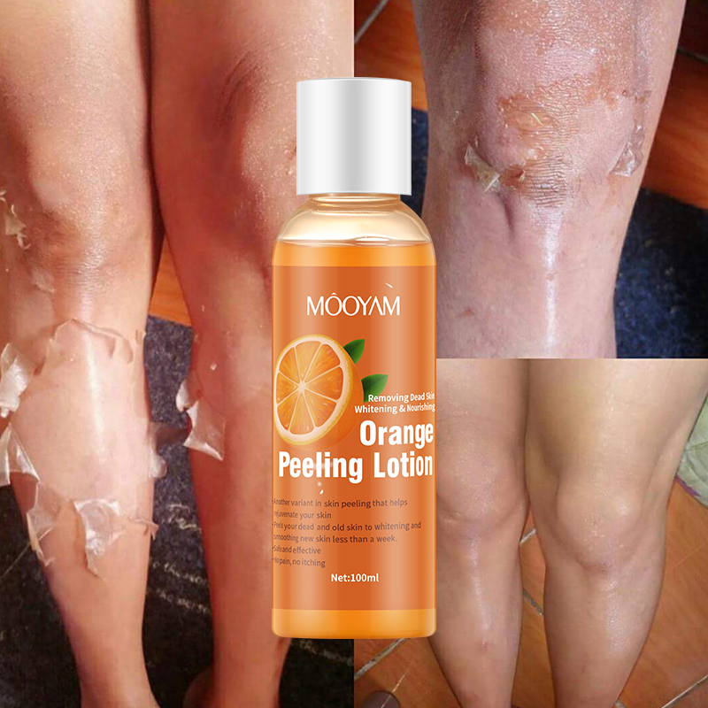 Orange Peeling Lotion Body Care Skin Whitening Cream Oil Organic Lotion for Removing Dead Skin Elbows, Knees Whitening Knuckles Remover Dark Spots Remover Brightening -MOOYAM