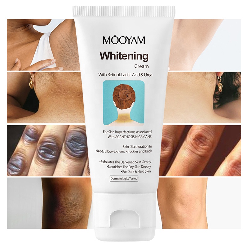 MOOYAM Whitening Cream with Retinol, Lactic Acid, Urea Acanthosis Nigricans Remove Black Patches Dark Spot Corrector Knee Elbow Underarm Knuckles Neck Lightening Skin Cream