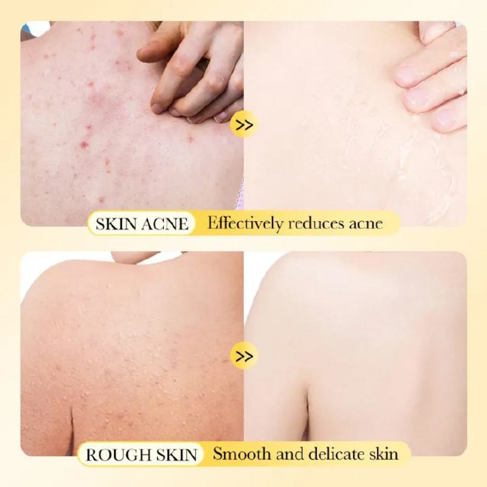 Sadoer 3 Pieces Soap, Sulfur Mite Removal Soap + Kojic Acid Soap + Turmeric Anti Acnes Soap Tumeric Soap, Eliminate Acne, Smoothen Skin, Shrink Pores, Gentle Cleansing