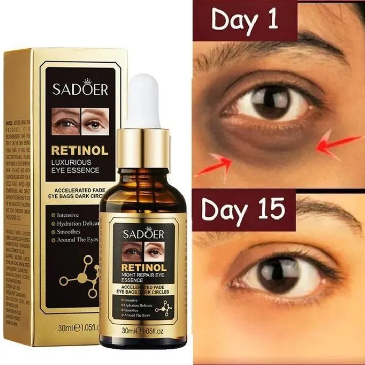 Retinol Eye Serum for Eye Bags Dark Circle Remover Anti-Puffiness Wrinkles Dark Eyebag Removal Serum Anti-Aging Moisturizing Brightening Lifting Face Serum 30ml - SADOER -