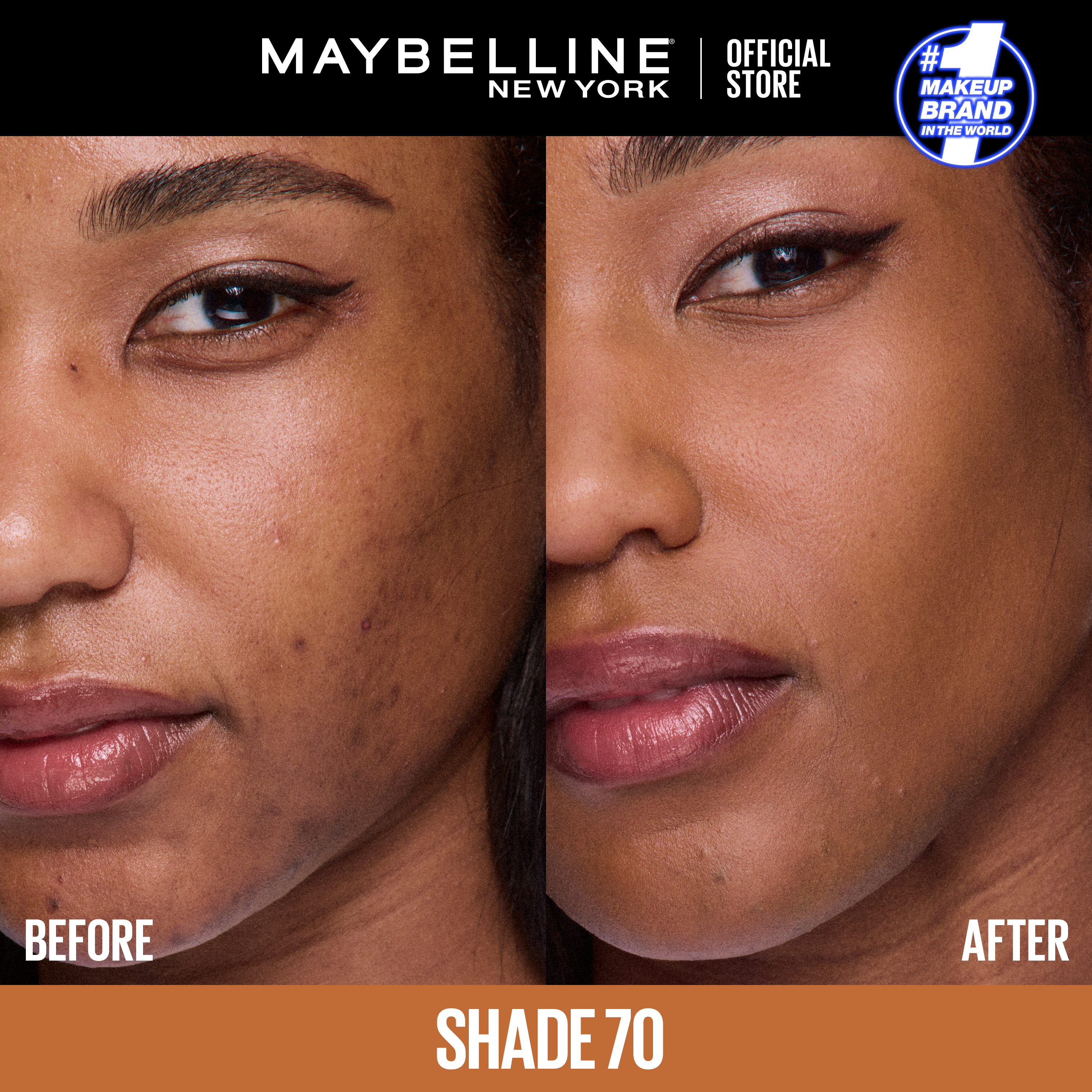 Maybelline Fit Me Spot Rescue Breathable Full Coverage Concealer - Shade 70, 15ml. Enriched with Salicylic Acid, Vitamin C and Glycerin for Blemish Correction and Radiant Skin