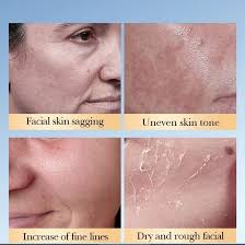 SADOER 7% Glycolic Acid + Ceramide Toner 230ml For Skin Renewal, Exfoliation, Anti-Dark Spots, Smooth Texture & Radiant Youthful Glow Brightens, And Restores Skin For A Clear, Smooth And Radiant Glow