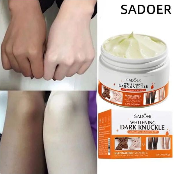 Whitening Cream For Dark Skin Joint,Elbows,Knees Lightening Intimate Area Underarm Body Care Private Parts Brighten Lotion Fade Melanin Bleaching Cream Remove Dark Pigment Moisturizing - SADOER
