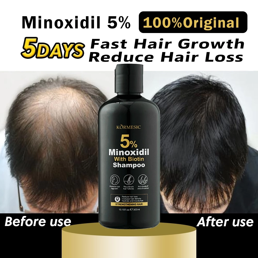 5% Minoxidil Shampoo Hair Growth, Biotin Ginseng and Ginger Hair Regrowth Shampoo for Thinning Hair, Scalp Care for Men and Women, Thicker Fuller Hair,Anti Hair Loss Treatment,Strengthens Roots