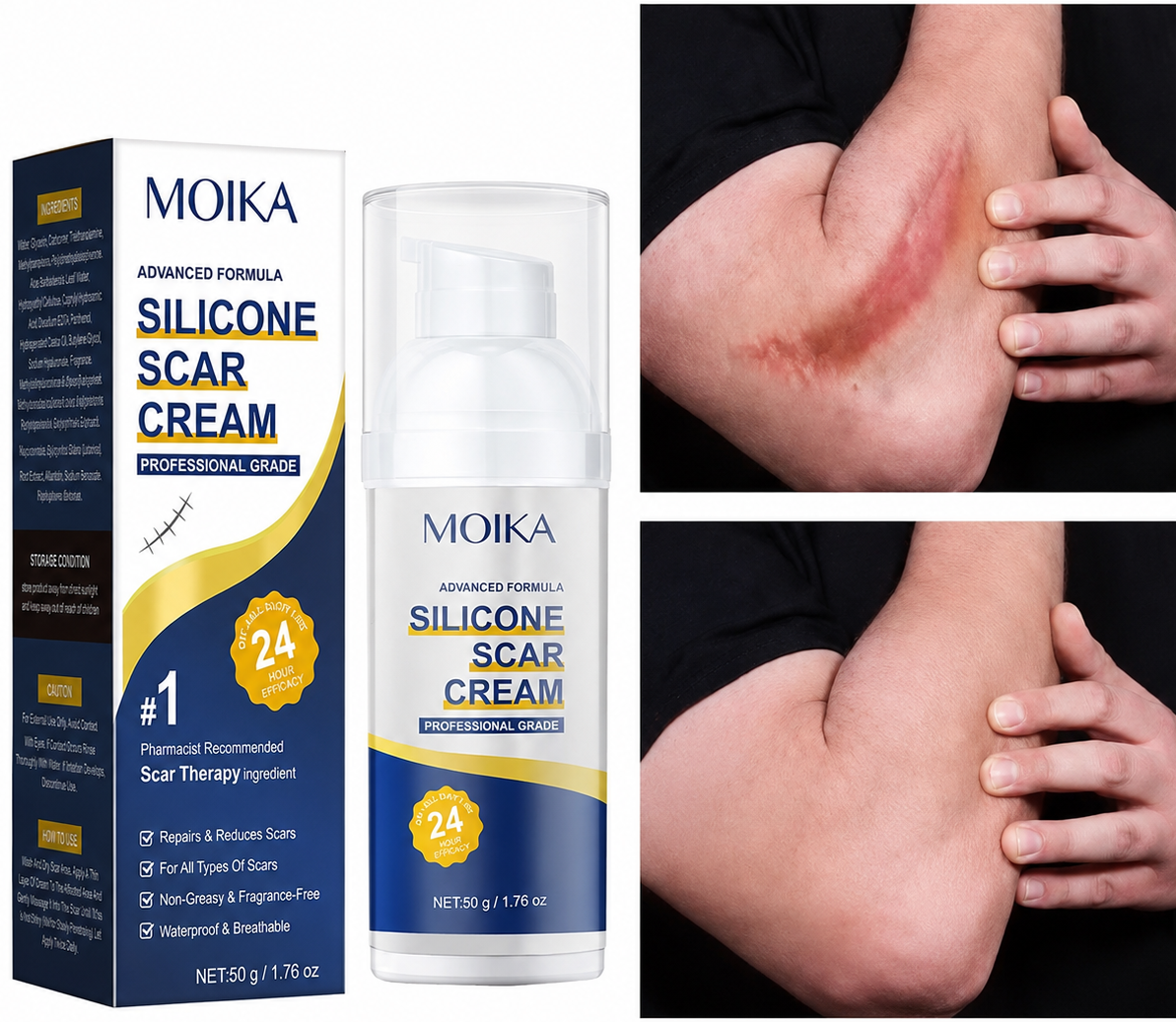 Removes Scars, Scar Treatment, Silicone Scar Remover Gel Cream, Advance Scar Gel - Treats Old and New Scars -Moisturizing Rejuvenating Skin Care Products for Surgical Scars and Keloid Bump-50g