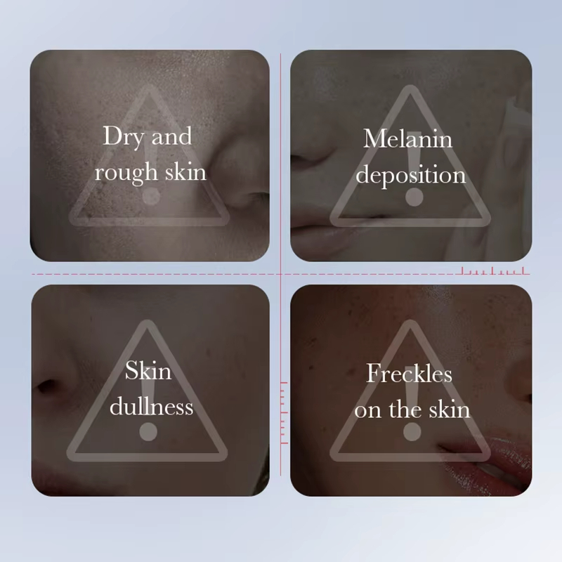 SADOER Kojic Acid Whitening and Freckle Removal Face Serum Moisturizing Facial essence Anti-Aging Wrinkle Serum Skin Care